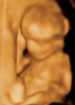 gender check ultrasound